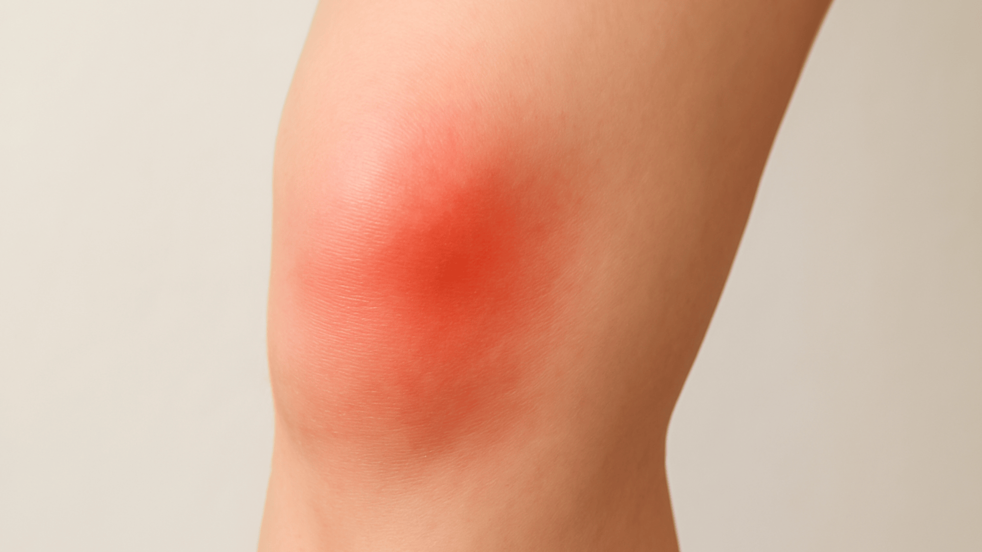 sharp pain in knee cap