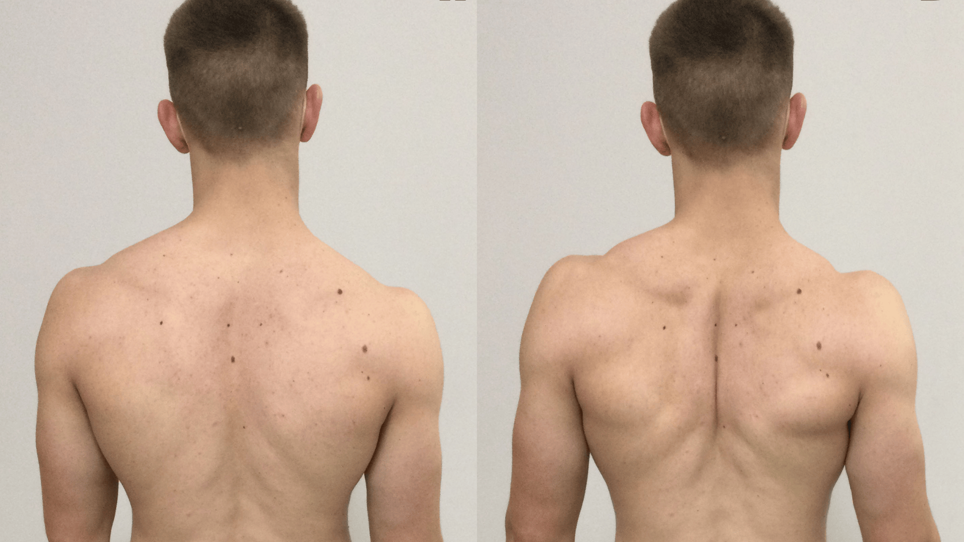 shoulder blade squeezes